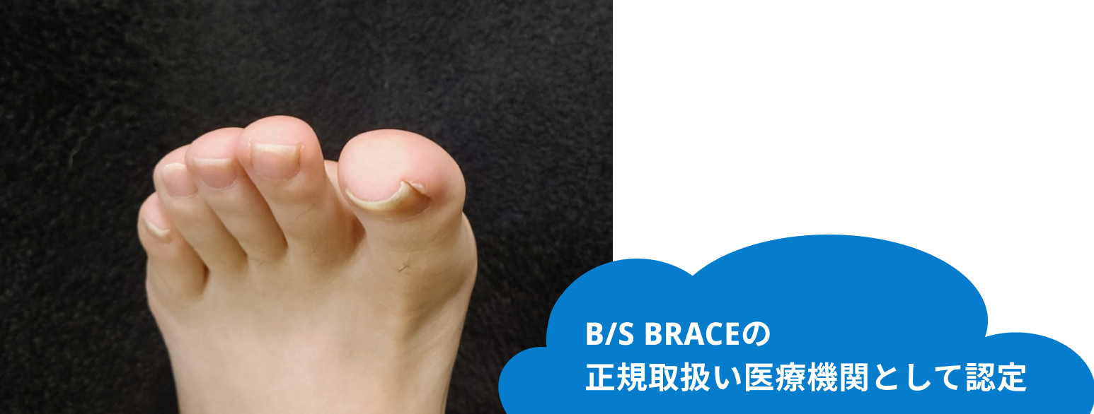 巻き爪の専門的な治療にも対応